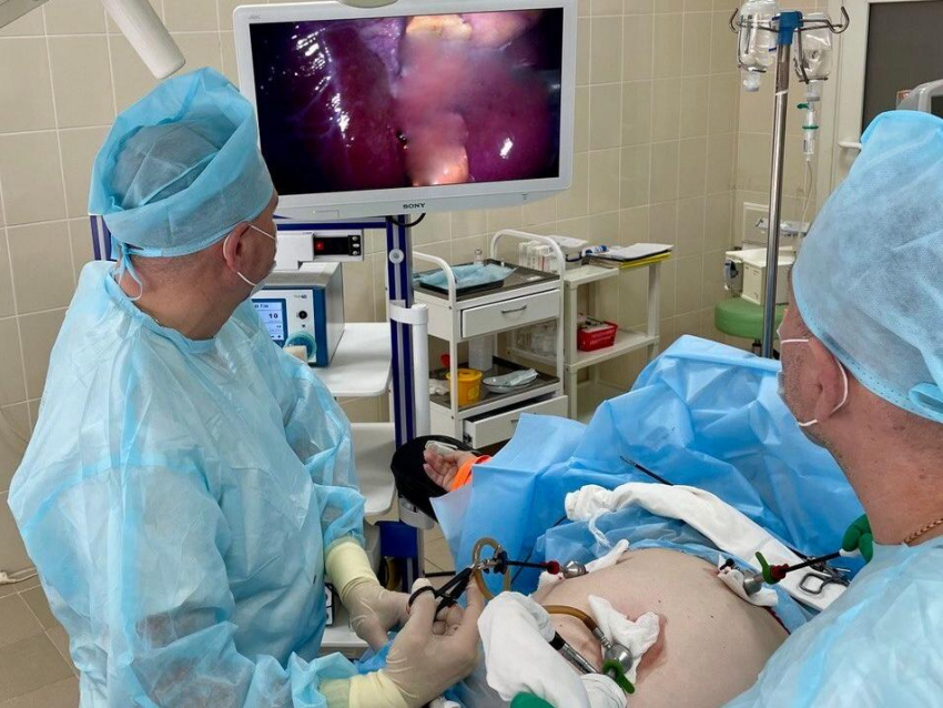 Воронежские хирурги достали три камня из желчного протока без единого разреза