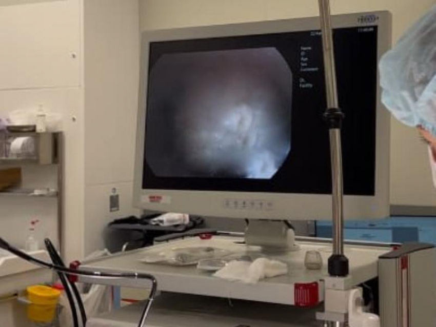 Воронежские врачи столкнулись с редкой опухолью, растущей наружу из горла