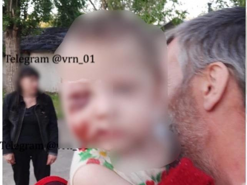 Мать, избившую годовалую дочь, отправили в СИЗО в Воронеже