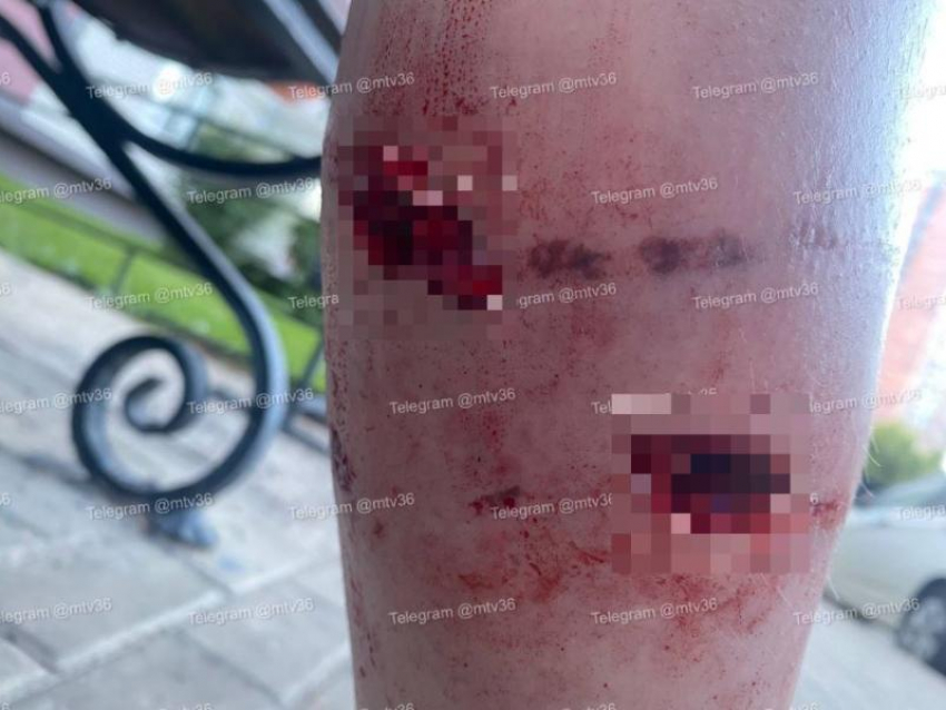 Стая бешеных собак набросилась на девушек в воронежском ЖК – им прокусили ноги