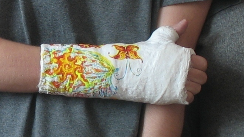 В Воронеже задержали наркокурьера с героином в гипсе