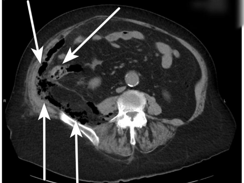 Чудо совершили воронежские врачи