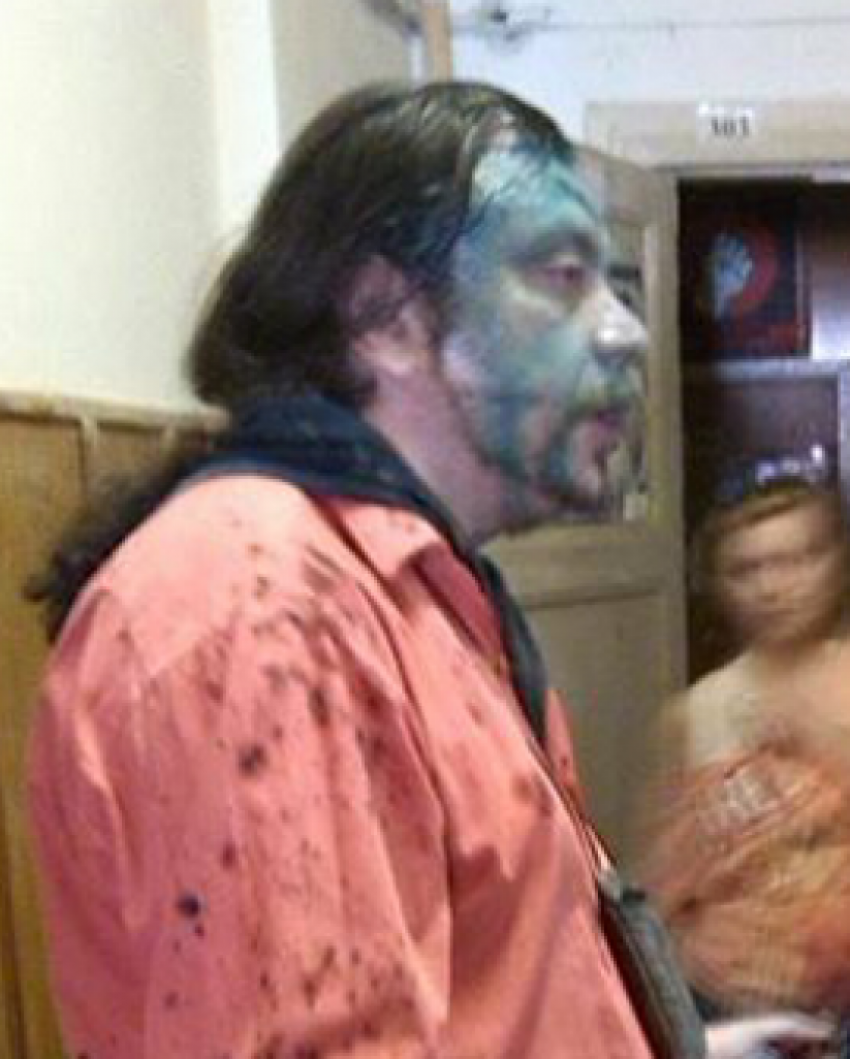 В Воронеже возбудили уголовное дело в связи с нападением на Андрея Юрова