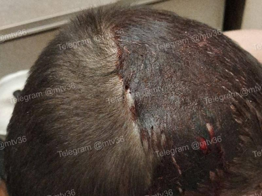 Школьники разбили голову прохожему в Воронеже
