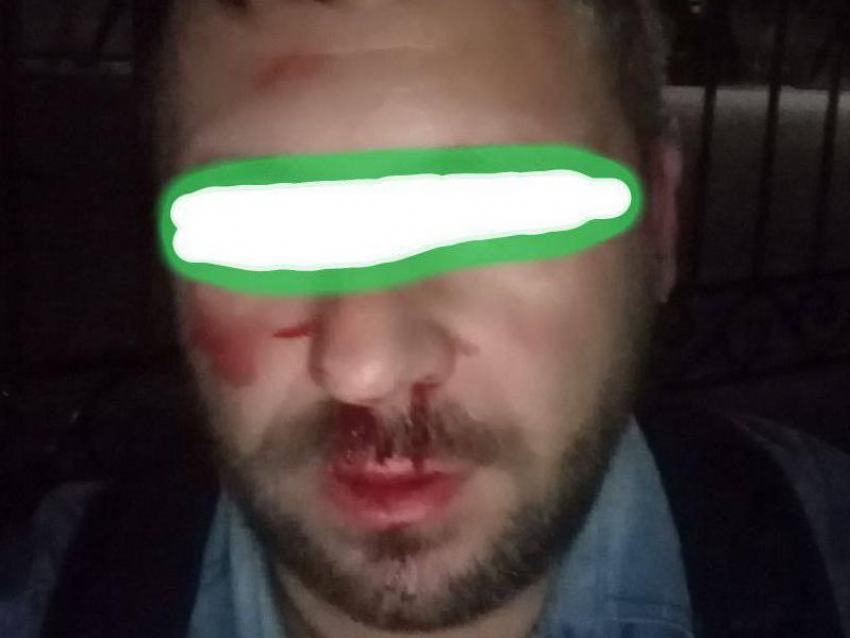 Избитому в воронежской Воле наблюдателю не потребовалась госпитализация