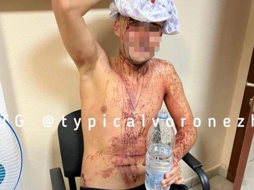 Воронежец ударил соседа кухонным топориком по голове 