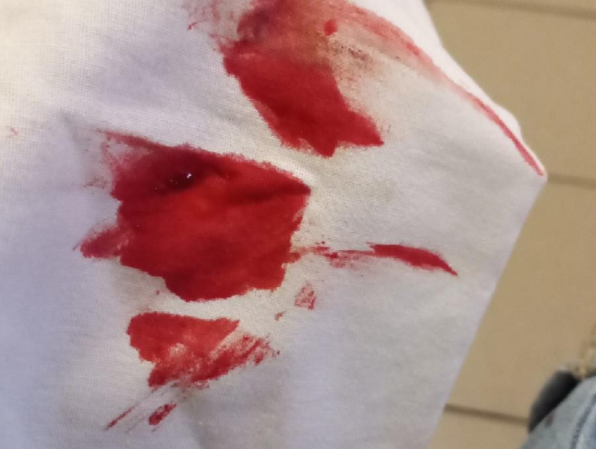 «Чудом выжил»: воронежца жестоко избили в собственной квартире 