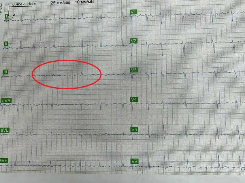 Супруга уговорила мужа лечь в больницу и предотвратила трагедию в Воронеже