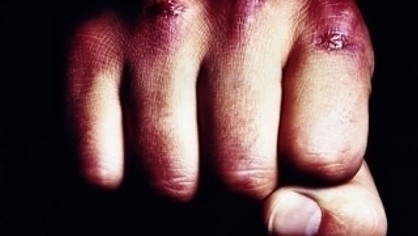 Воронежский житель остался без глаза